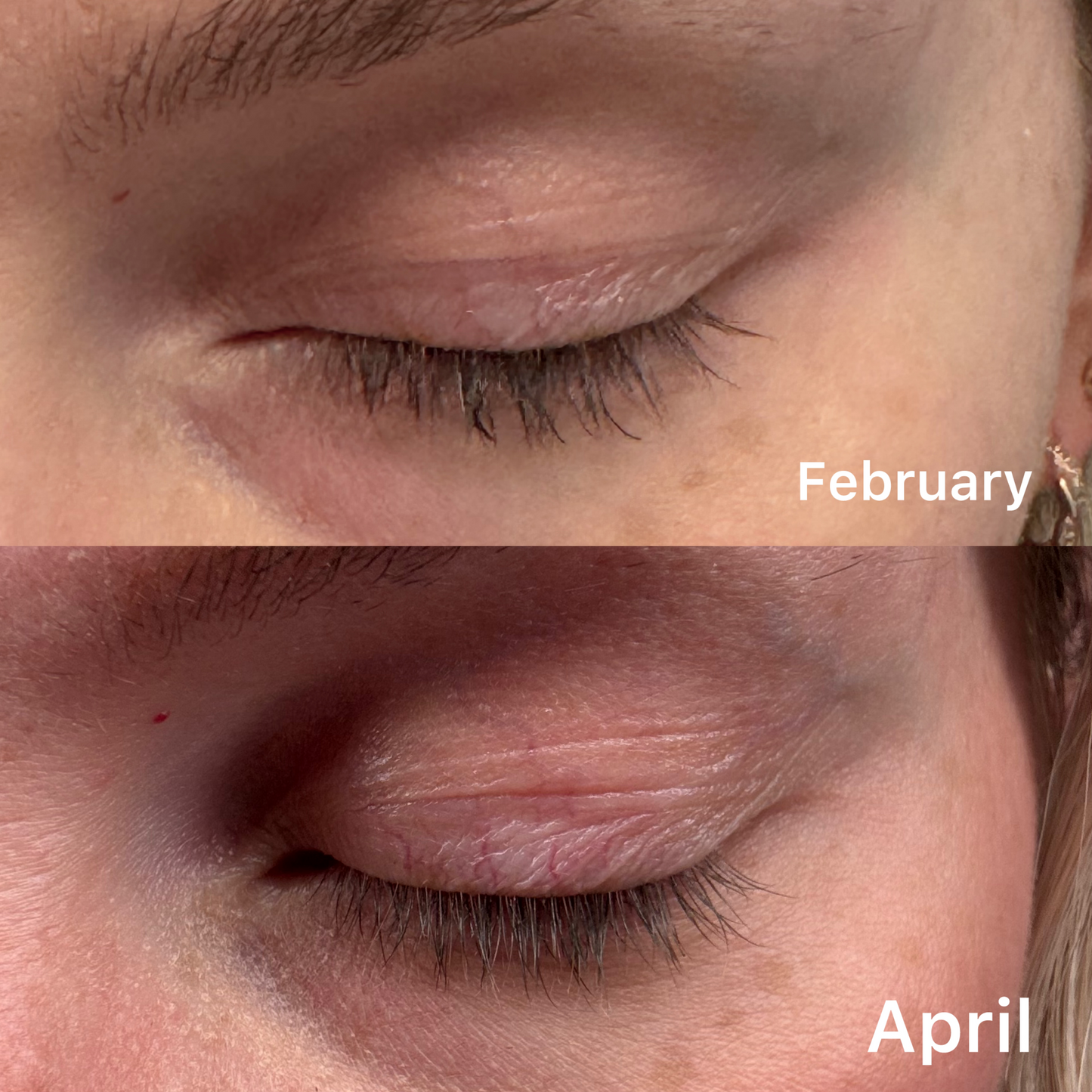 Lash & Brow Growth Serum