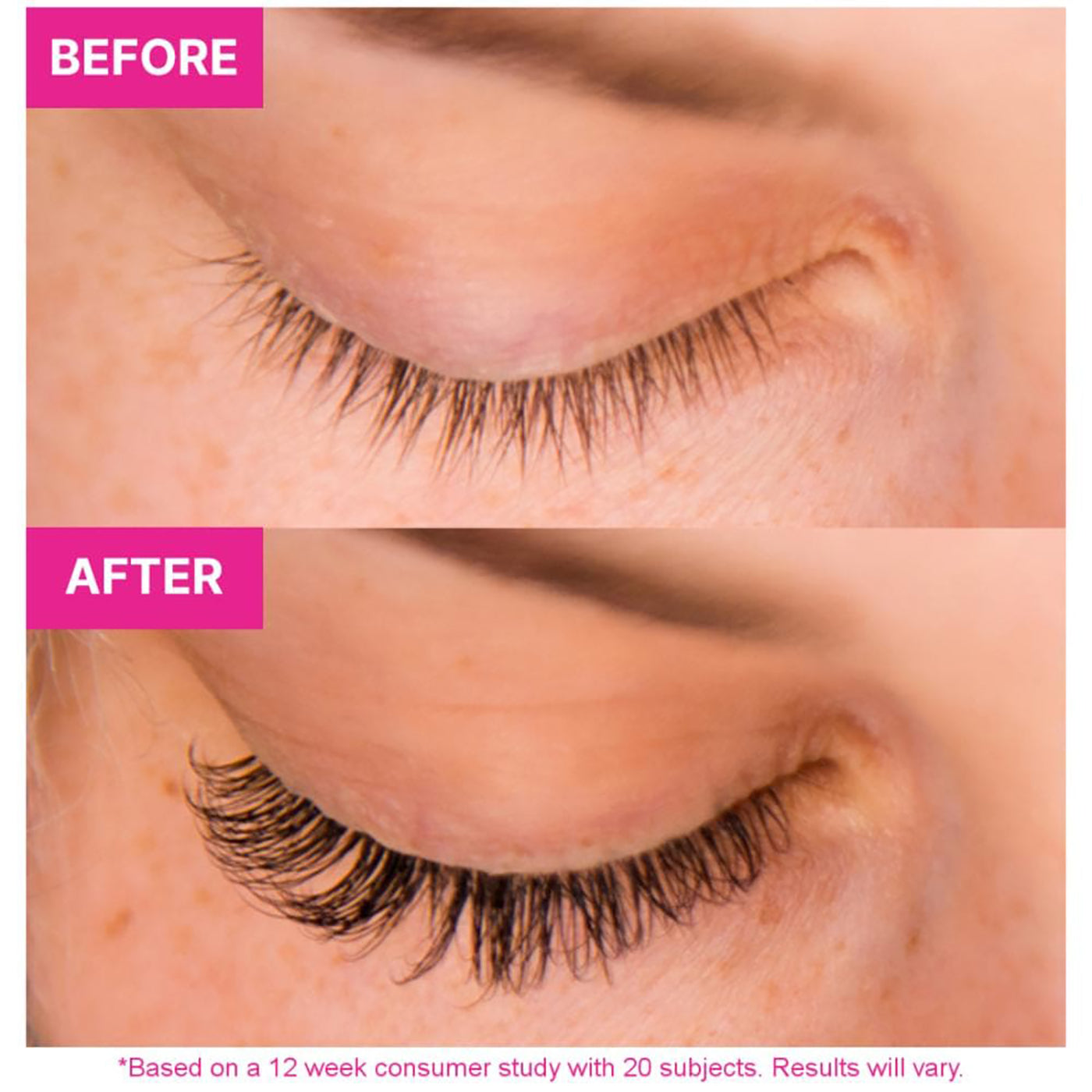 5ml Professional Eyelash Growth Serum